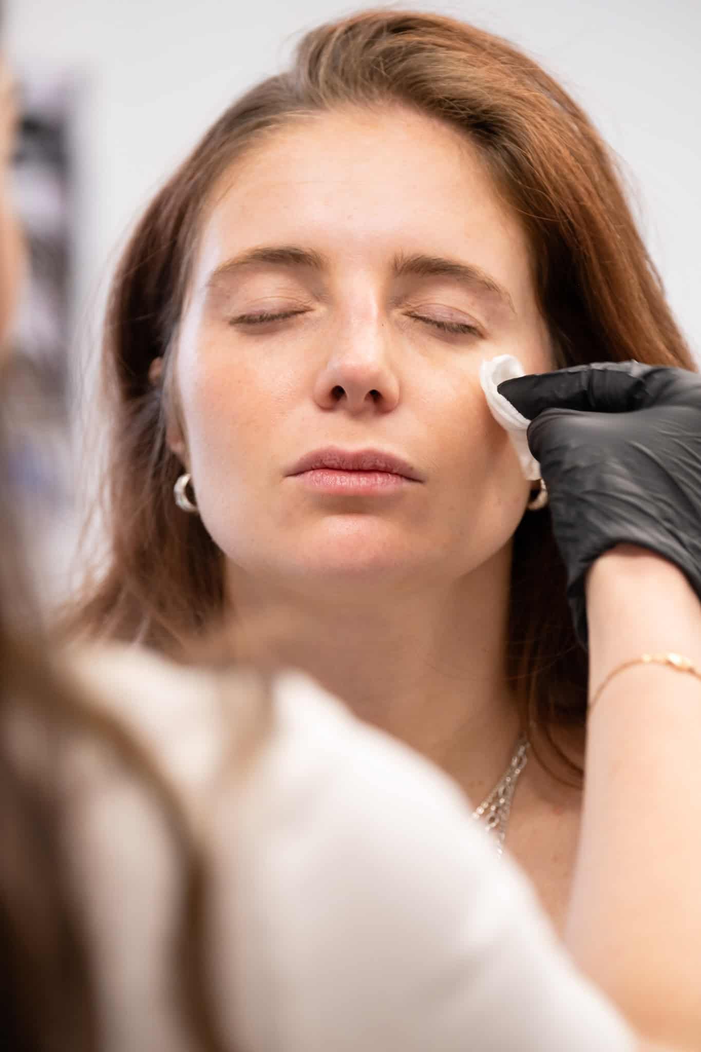 Dermal Fillers preparation
